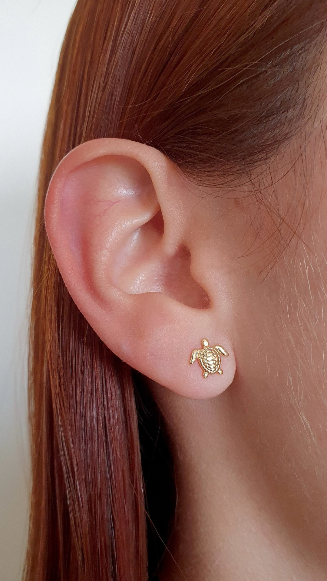 Arete Turtle