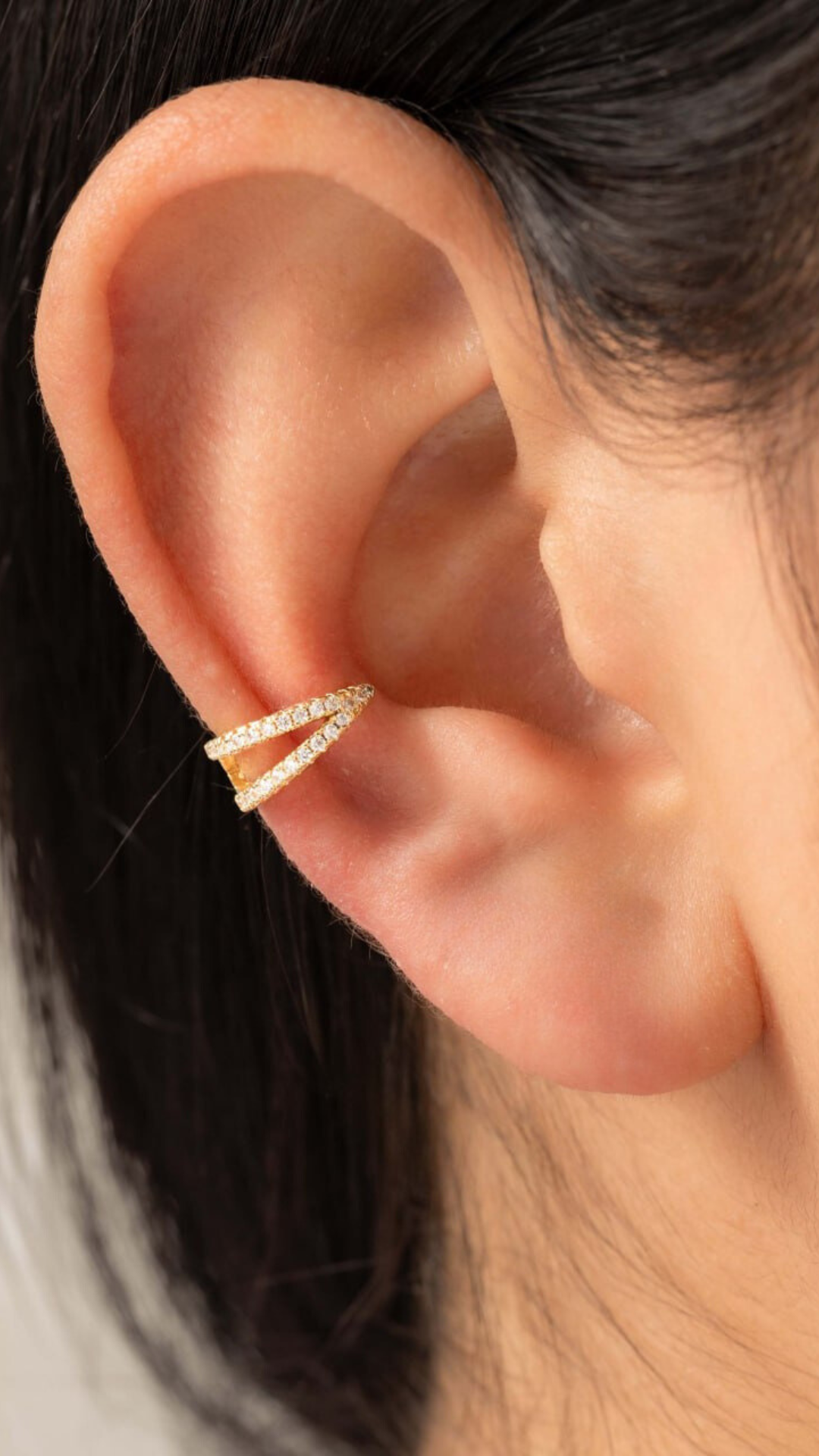 Arete Stunning