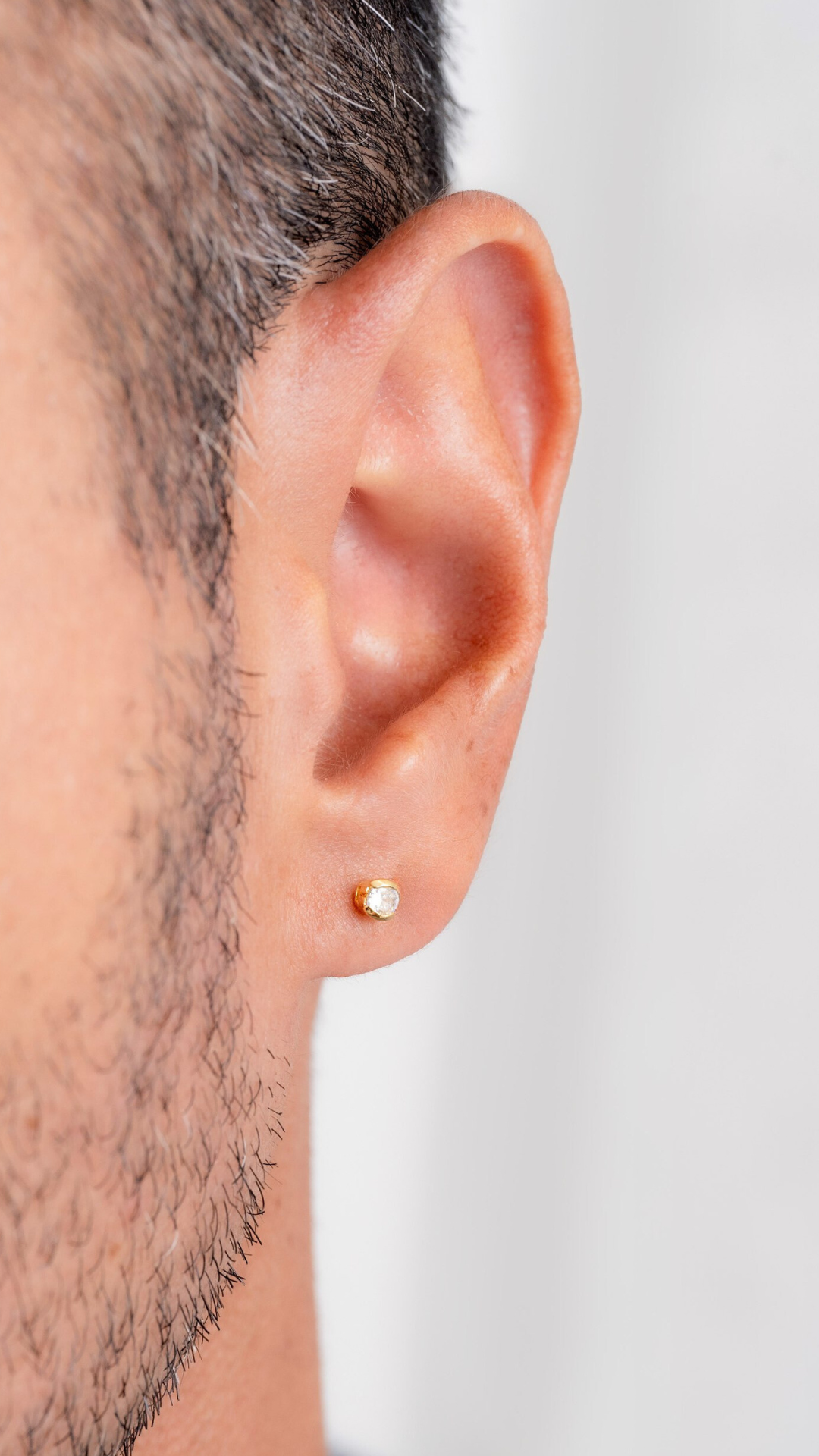 Arete Charming
