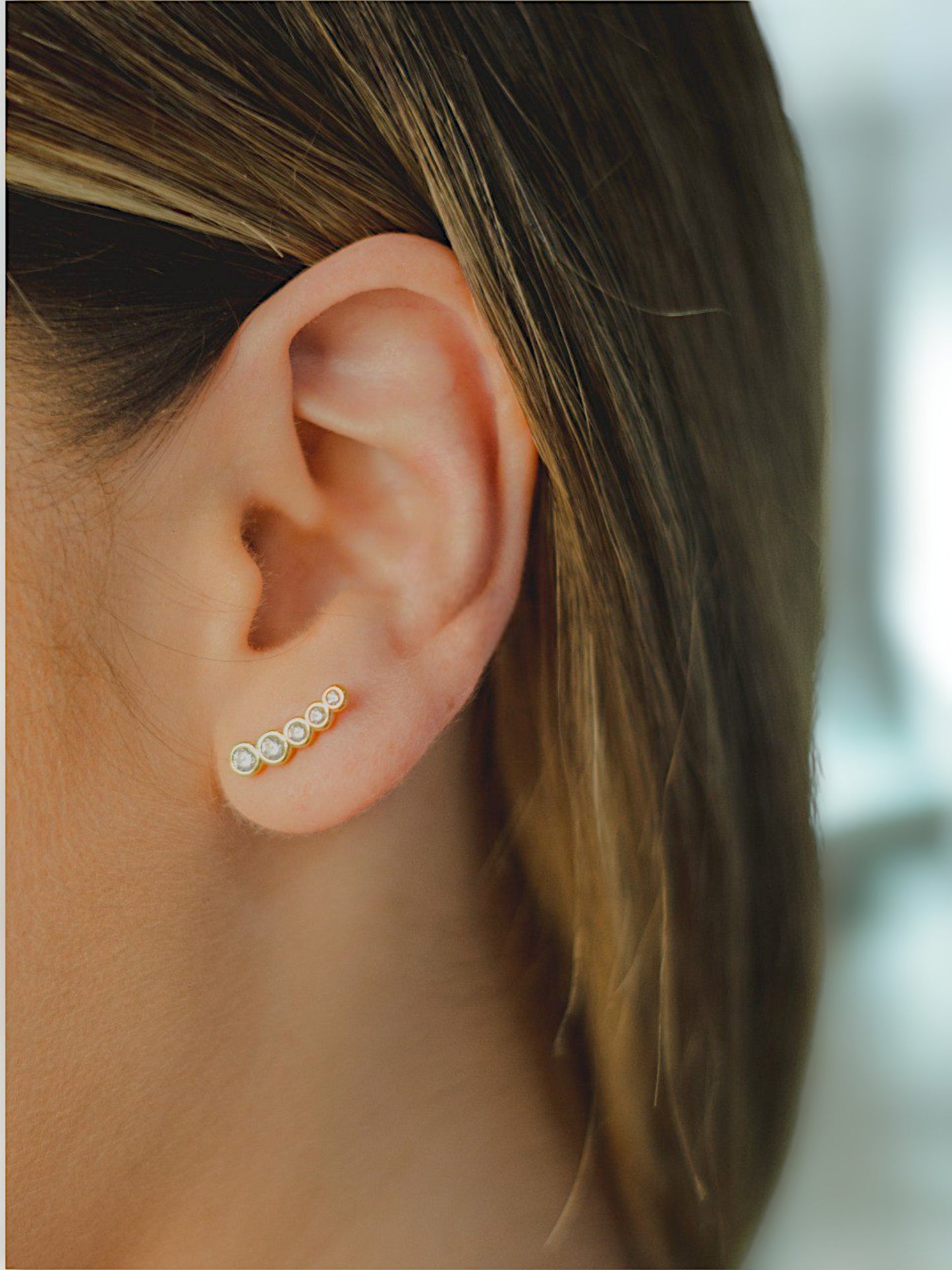 Arete Scaler
