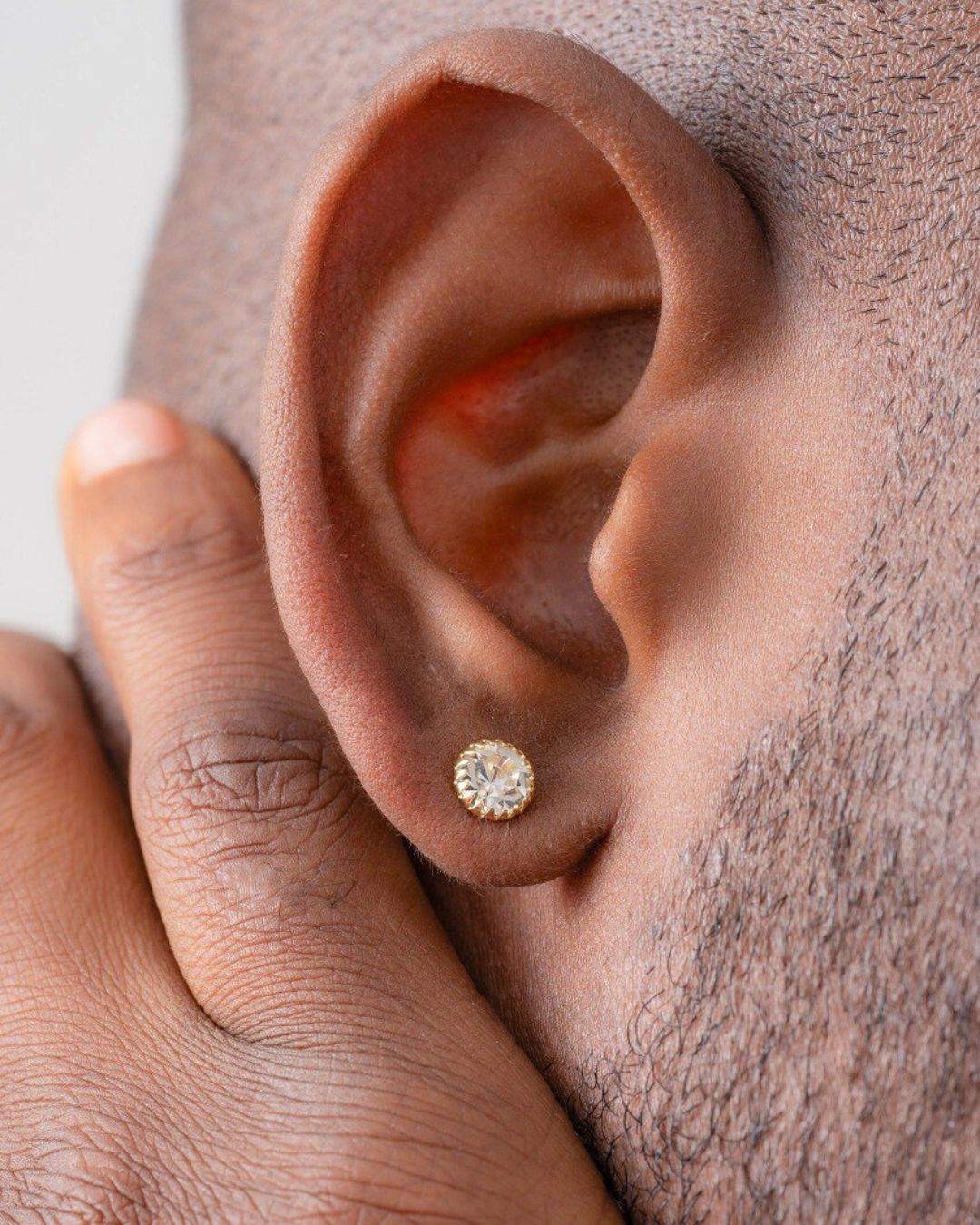Arete Circon